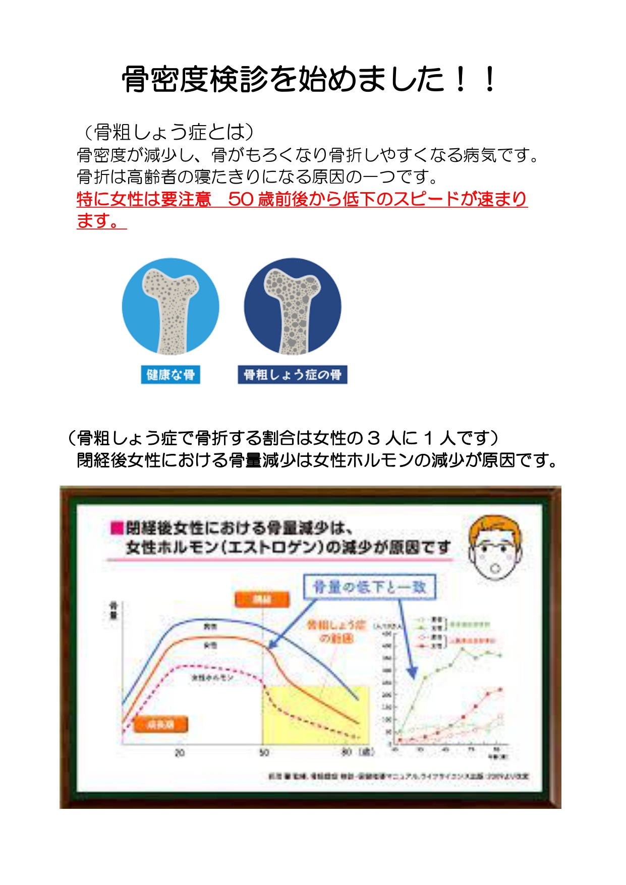 骨密度検診（DEXA）を始めました – 相模原赤十字病院